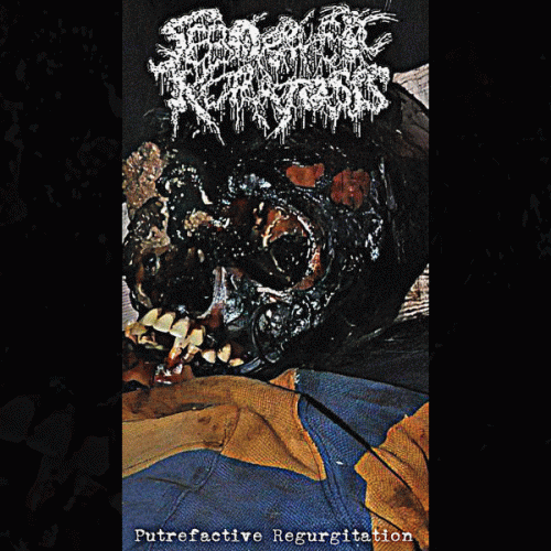 Seborrheic Keratosis : Putrefactive Regurgitation